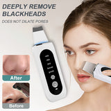 Ultrasonic Deep Skin Scrubber