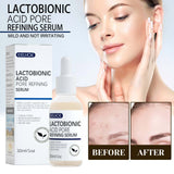 Lactobionic Acid Face Serum